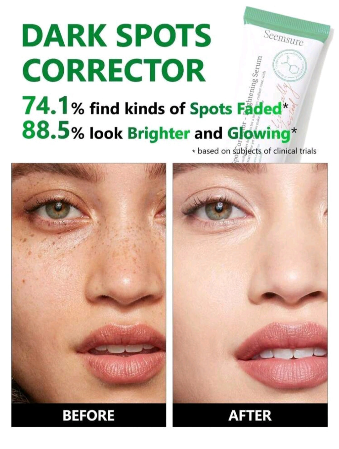 Dark spot corrector (50ml)