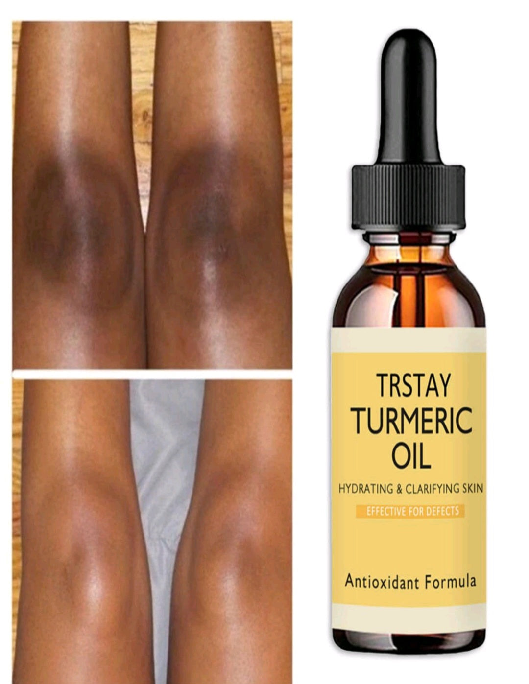 Turmeric oil (50ml)